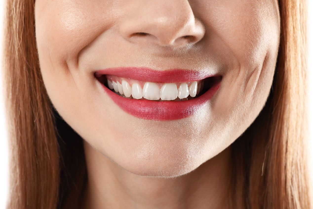 WHY ONLY A PROFESSIONAL TEETH WHITENING DENTIST SHOULD WHITEN YOUR TEETH