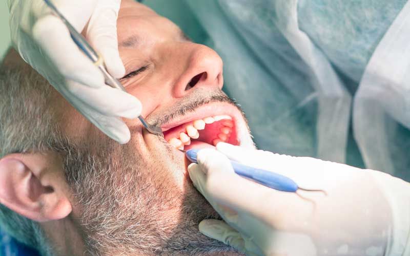 Cosmetic Fillings