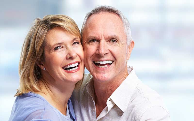 Veneers