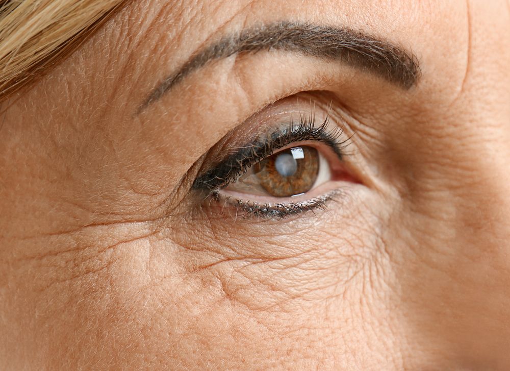 What Are the First Signs of Cataracts?