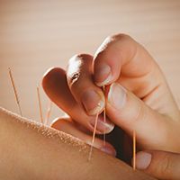 Wellness Tip: Consider Acupuncture