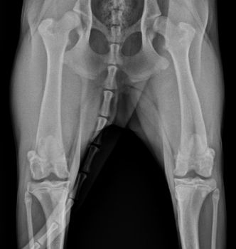 acl injury xray