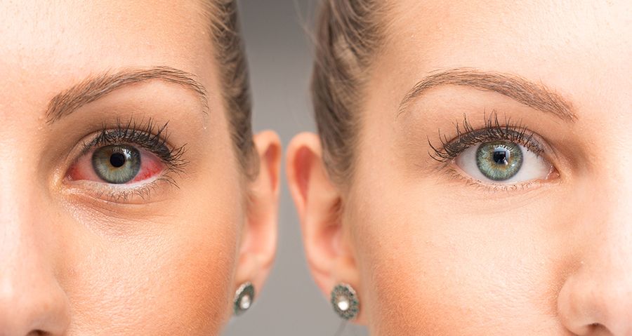Eye Disease Comparison