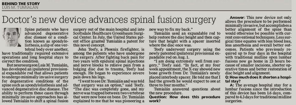 spine fusion surgery newspaper article