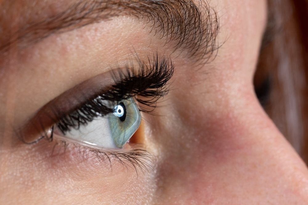 Keratoconus Unveiled: A Closer Look at this Eye Condition