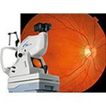 Topcon Retinal Camera