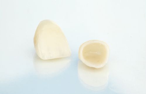 dental crowns