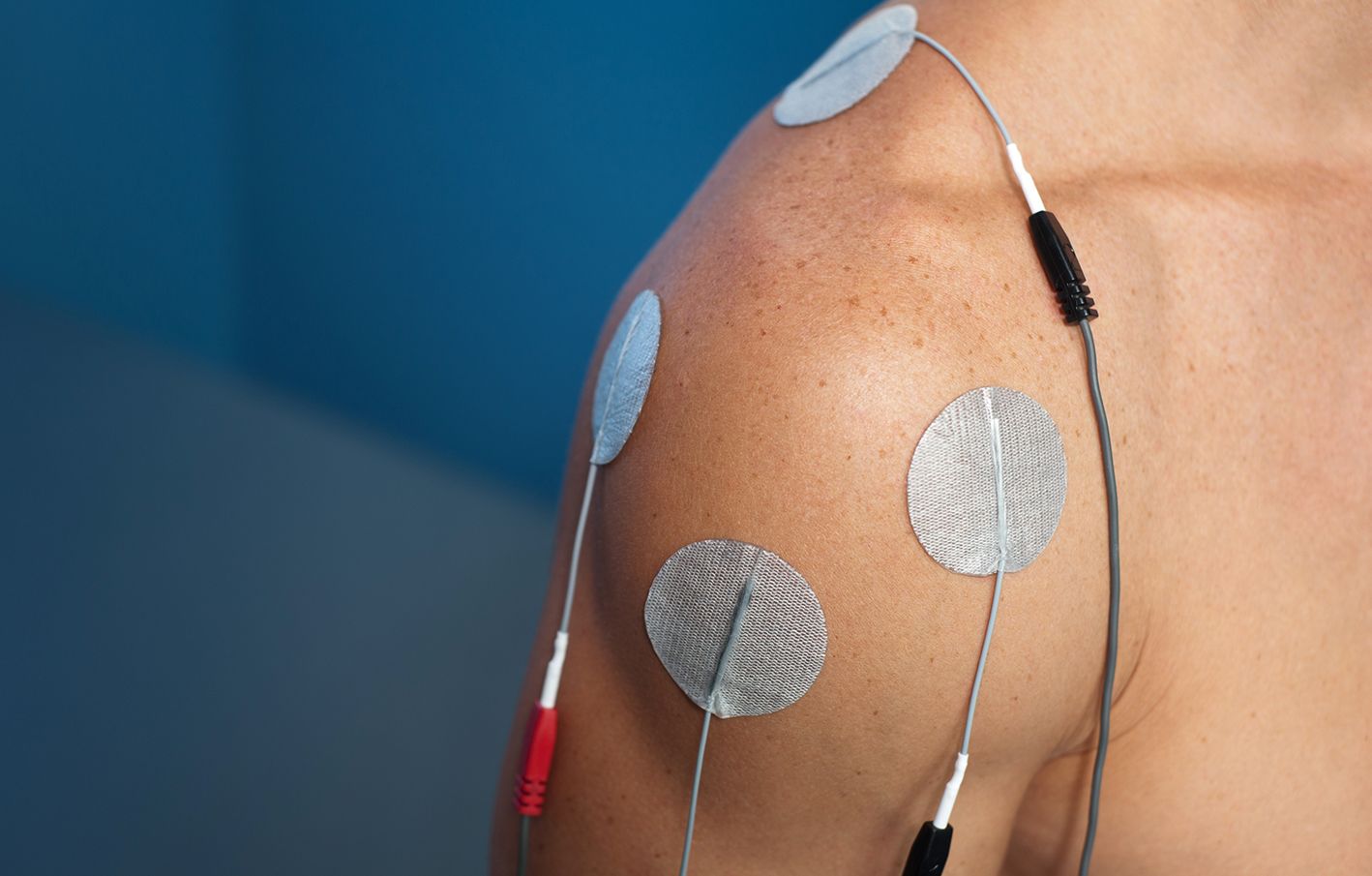 Electrical muscle stimulation