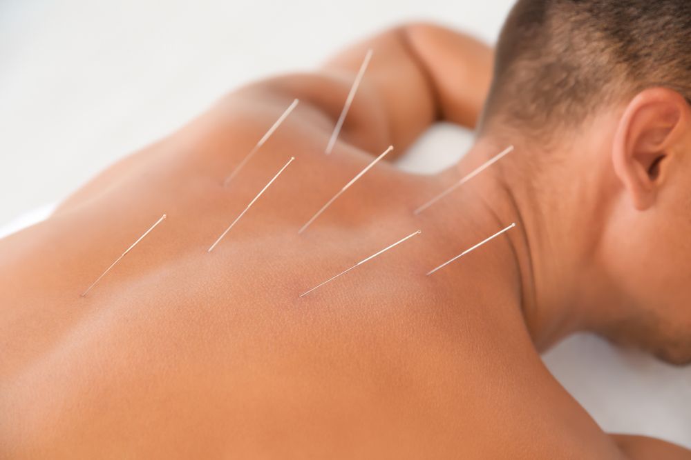 What Conditions Can Acupuncture Help With?