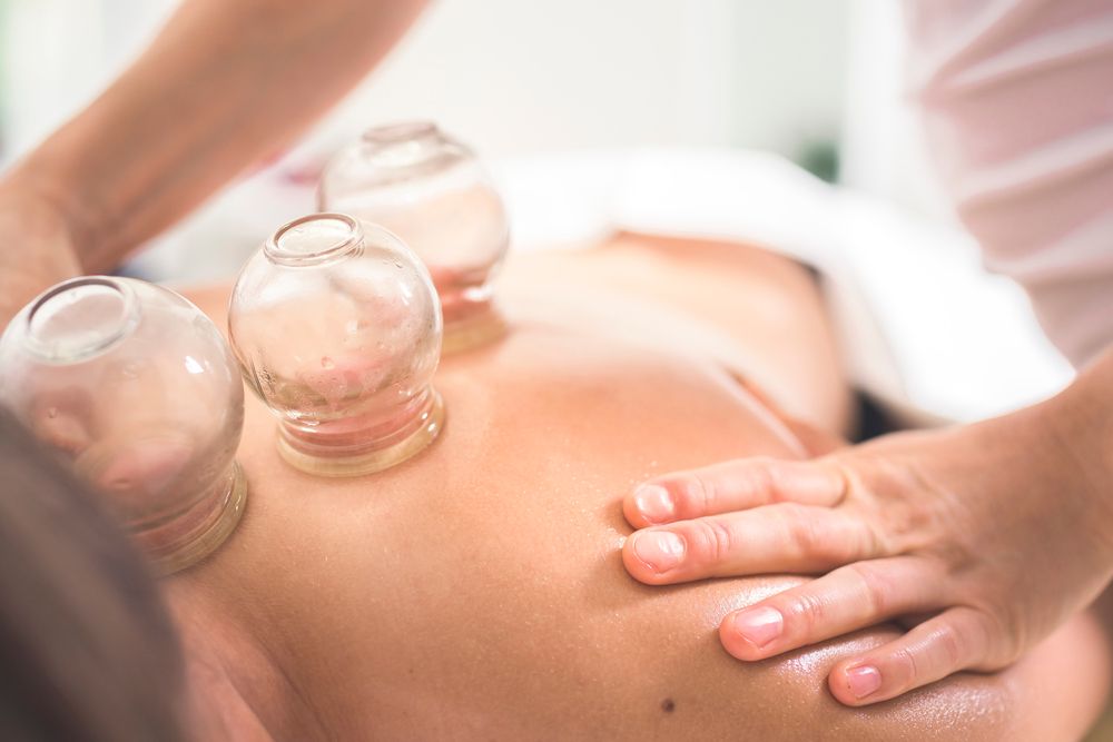 How Cupping Therapy Can Benefit Athletes