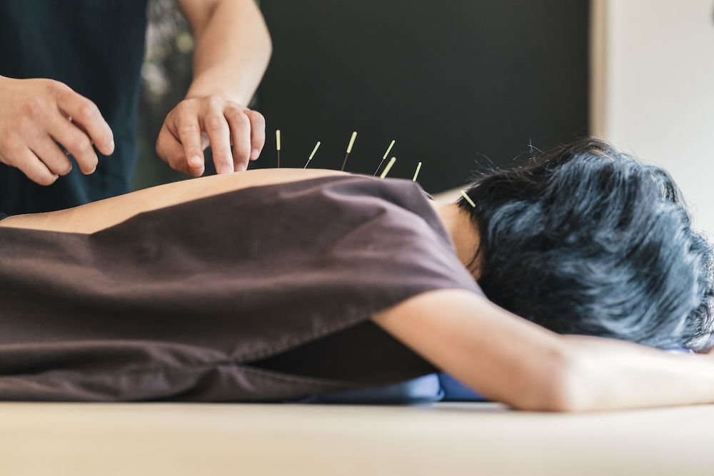How Acupuncture Helps With Pain Reduction