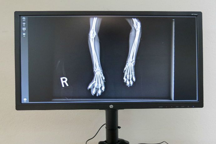 Digital Radiology (X-Rays)