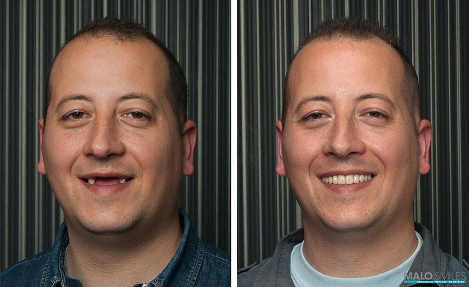 before and after results