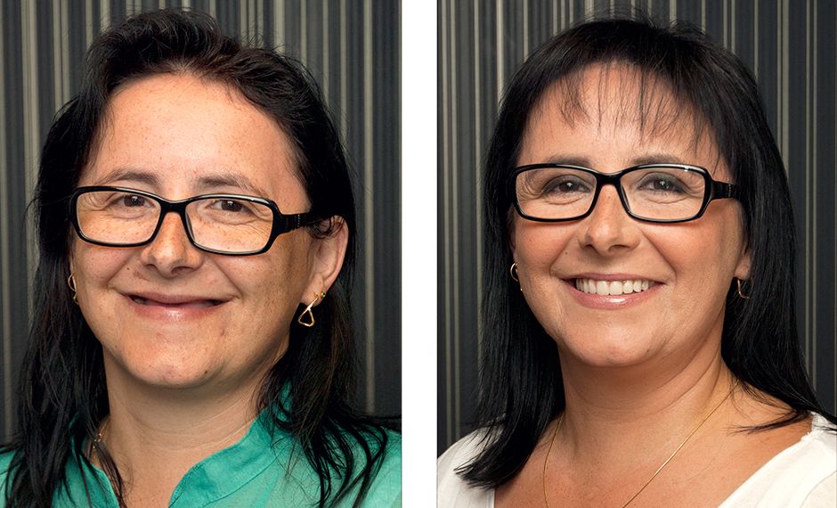 before and after results