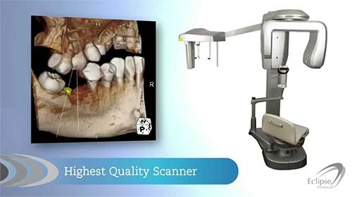 x-ray