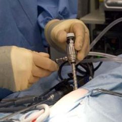 High Definition Laparoscopy