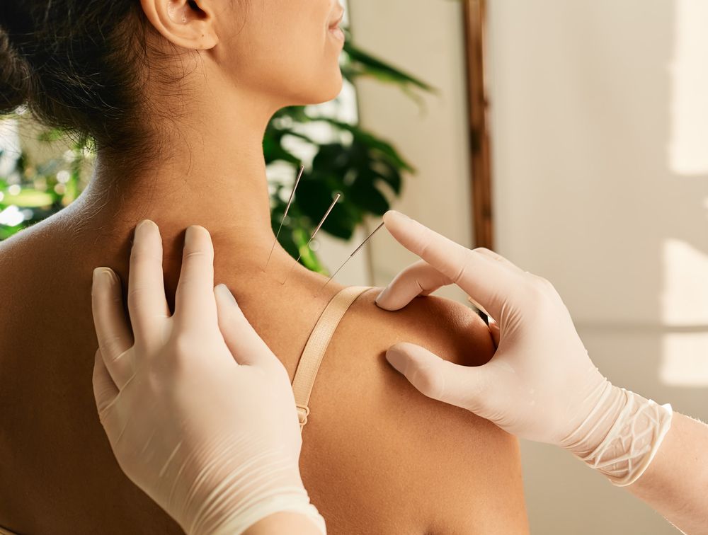 The Many Benefits of Acupuncture: From Pain Relief to Stress Reduction