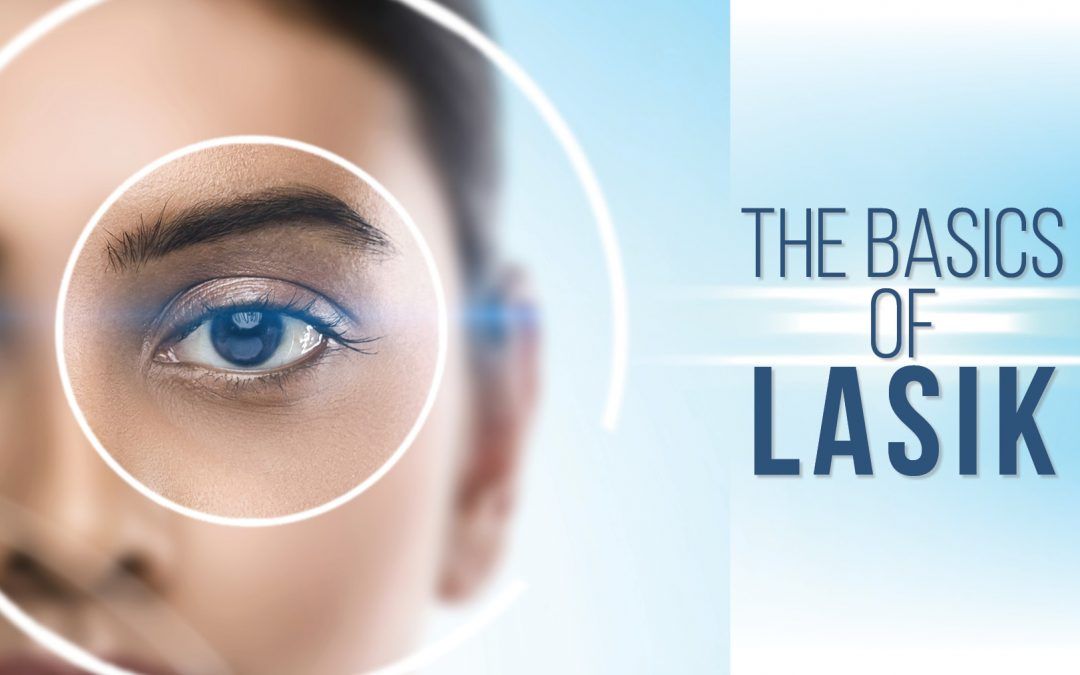 The Basics of LASIK