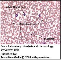 Autoimmune Hemolytic Anemia in Dogs