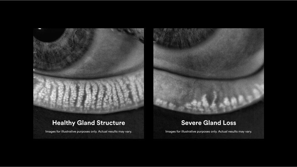 Gland Imaging