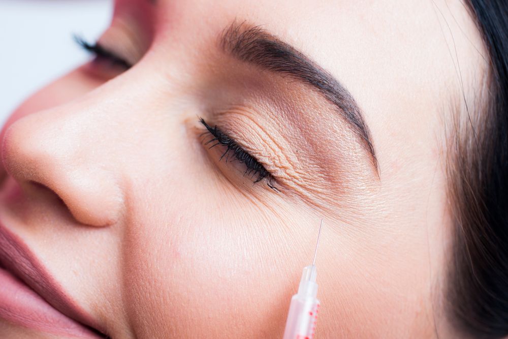 How Botox Can Rejuvenate Tired-looking Eye
