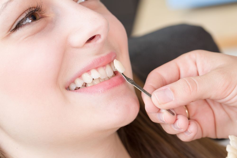 Common Reasons for Dental Crowns: Restoring Teeth for Function and Aesthetics 