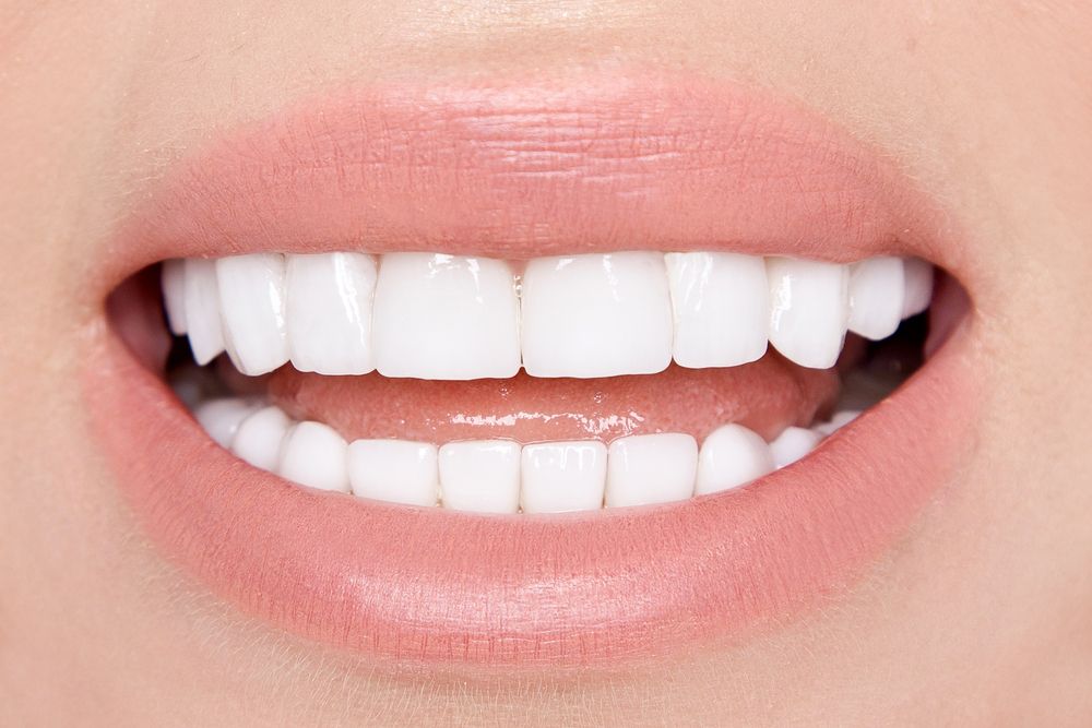 Dental Veneers vs. Crowns: Which Is Right for You?