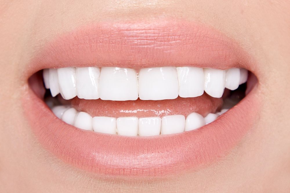 Dental Veneers vs. Crowns: Which Is Right for You?