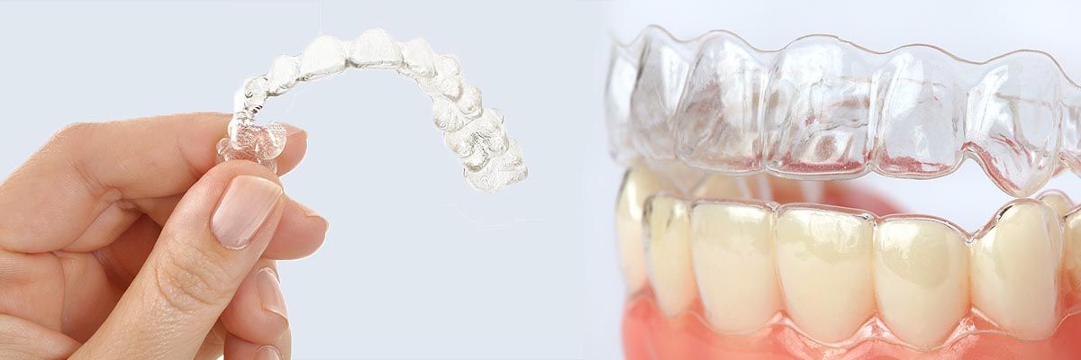 holding clear correct braces