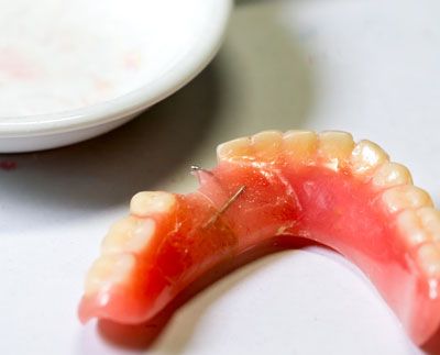 dentures