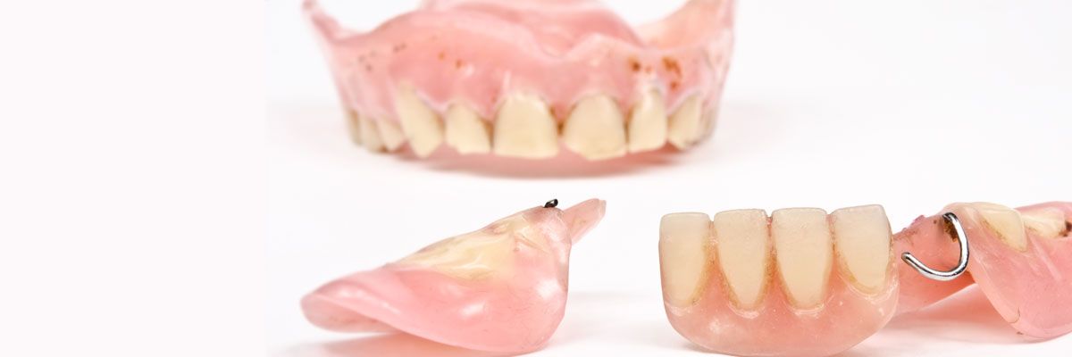 partial denture