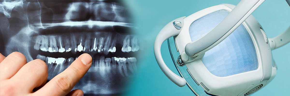 dental cleanings
