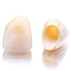 dental crown