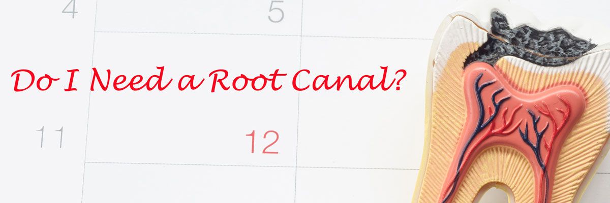 root canal infection