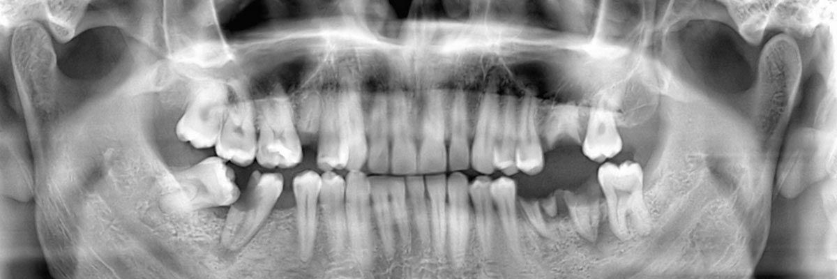 xray