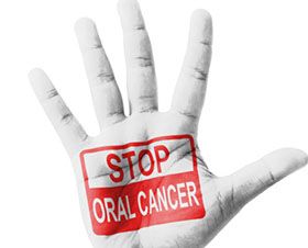 oral cancer screening