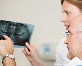 dental x rays