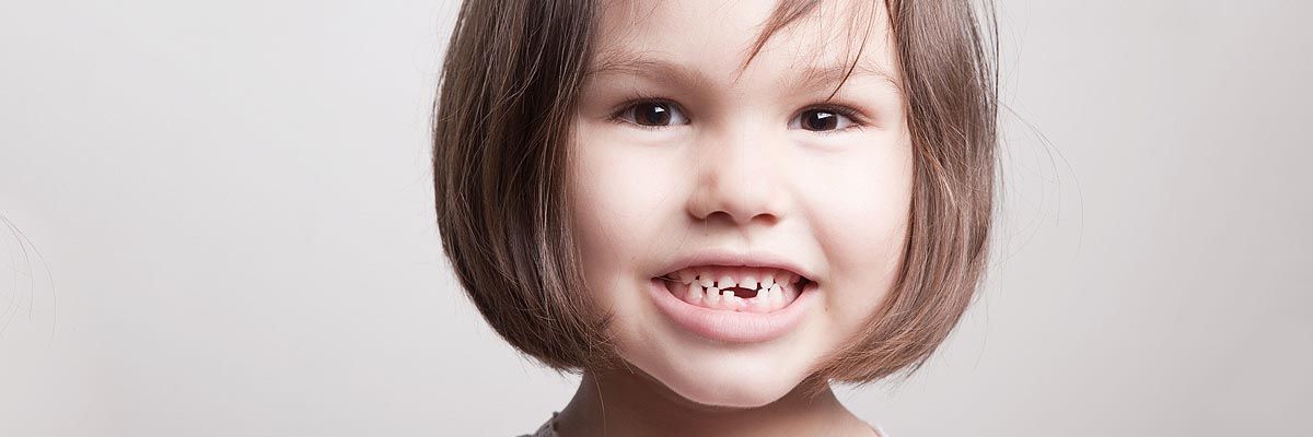 child with missing teeth