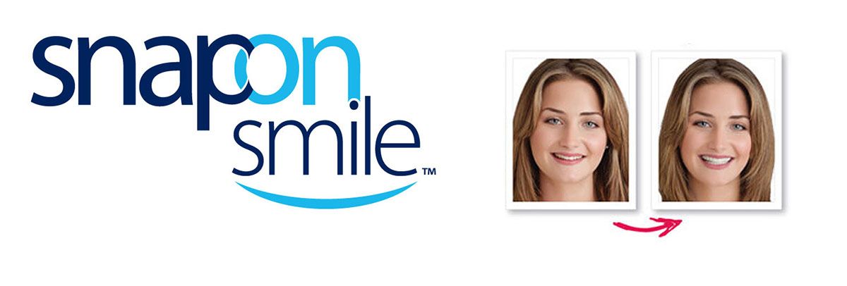 snap on smile logo
