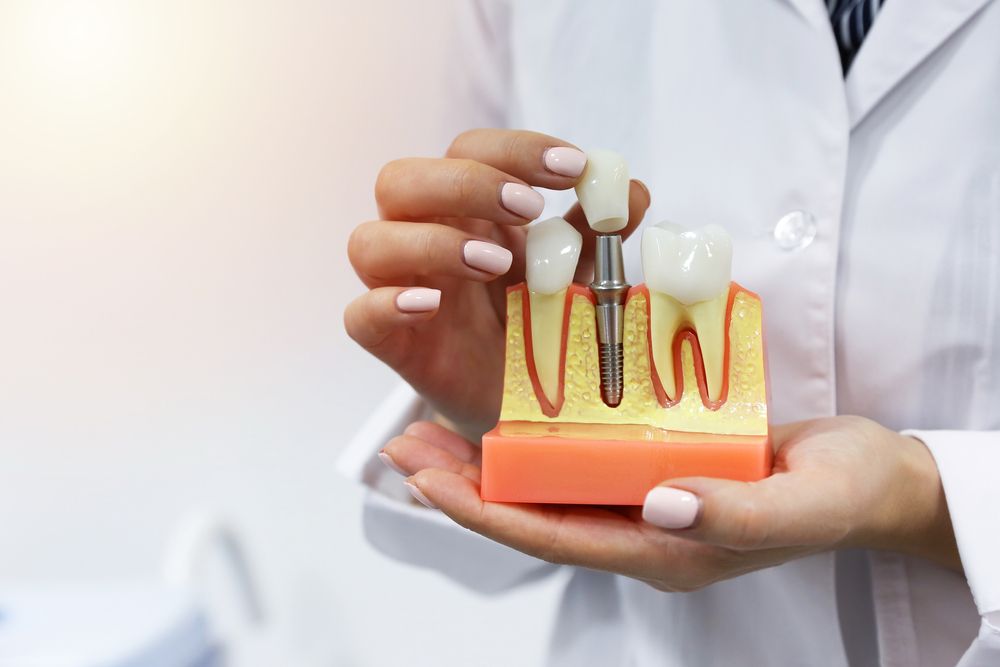 Dental Implants or Permanent Dentures: Which Is Right for You?