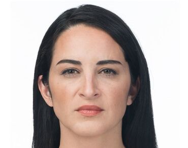 after botox