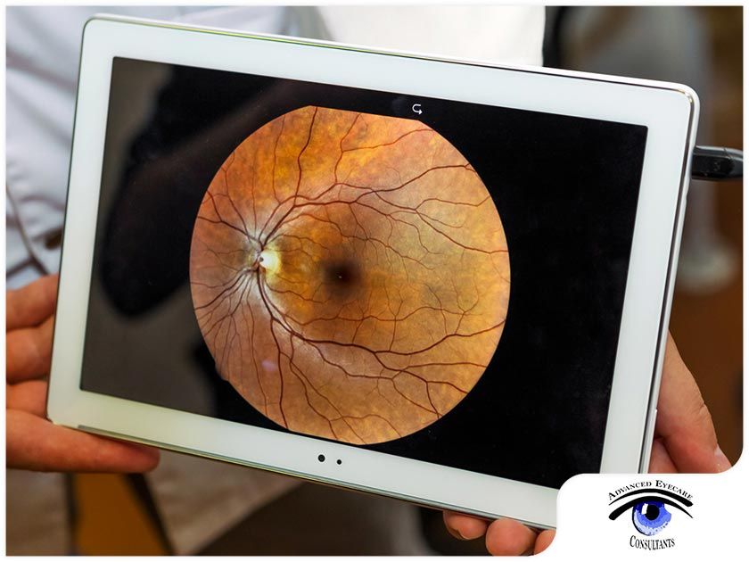 4 EYE DISEASES THAT CAN BE DETECTED VIA RETINAL IMAGING