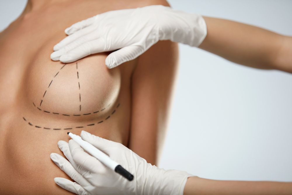 breast fat grafting