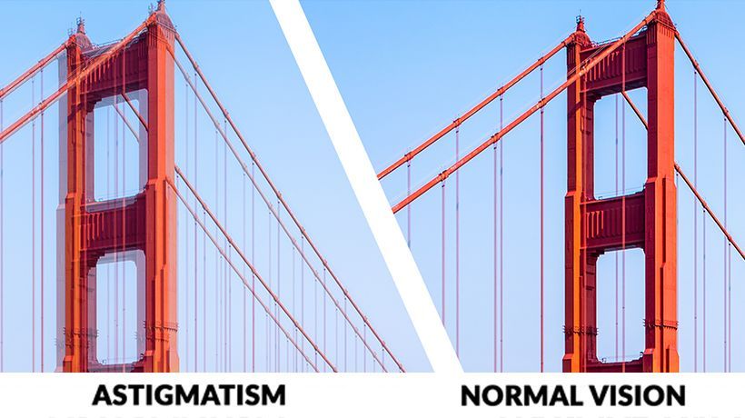 Astigmatism Explained