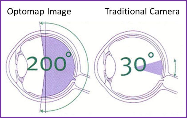 Retinal Camera