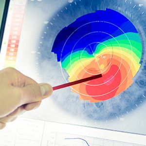 UPCOMING EVENT: Top 10 Things You Need to Know About Corneal Refractive Therapy (CRT)