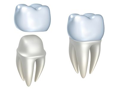 Dental cap