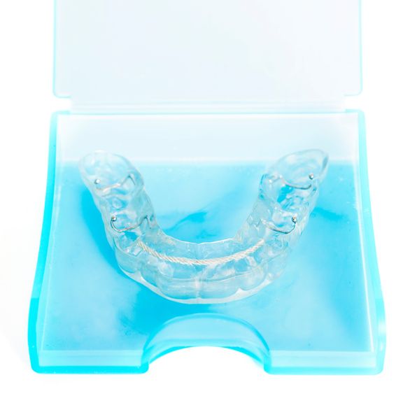 Mouth guards