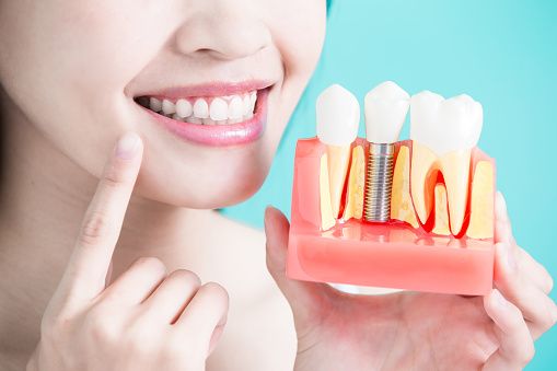 Girl with a beautiful teeth