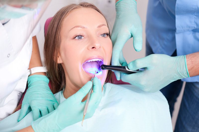 Dental Sealants